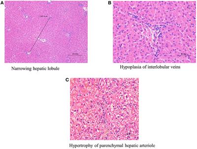 Clinicopathological Findings and Prognosis in Canine Cases Diagnosed As Primary Hypoplasia of the Portal Vein